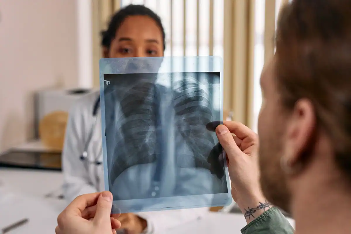 Medic ține în lumină o radiografie toracică, în fața unui pacient