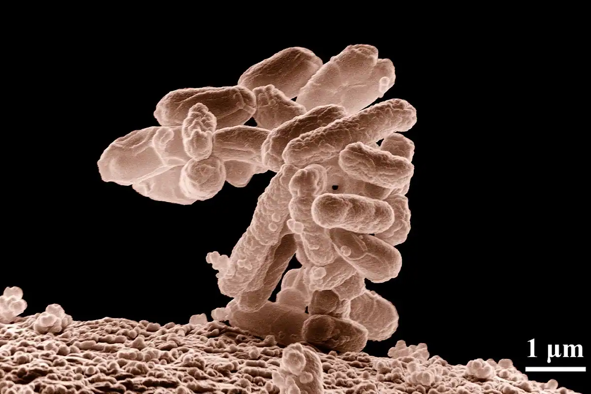 Bacterii în formă de bastonaș, văzute la microscopul electronic